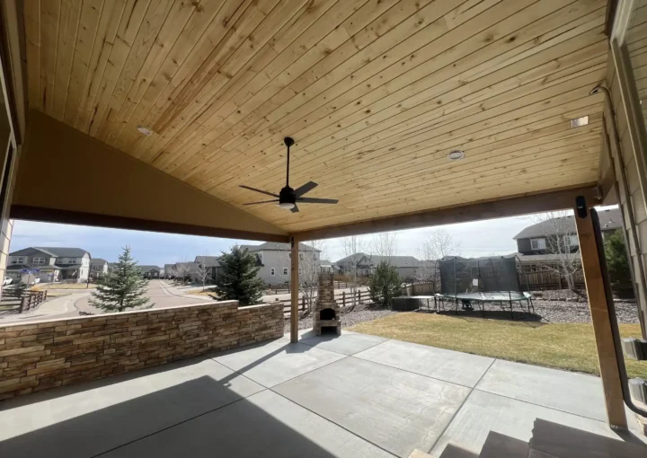 ca-carpentry-decks-pergolas-patio-covers-denver-colorado_005